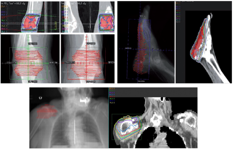 radioterapia osteoarticular